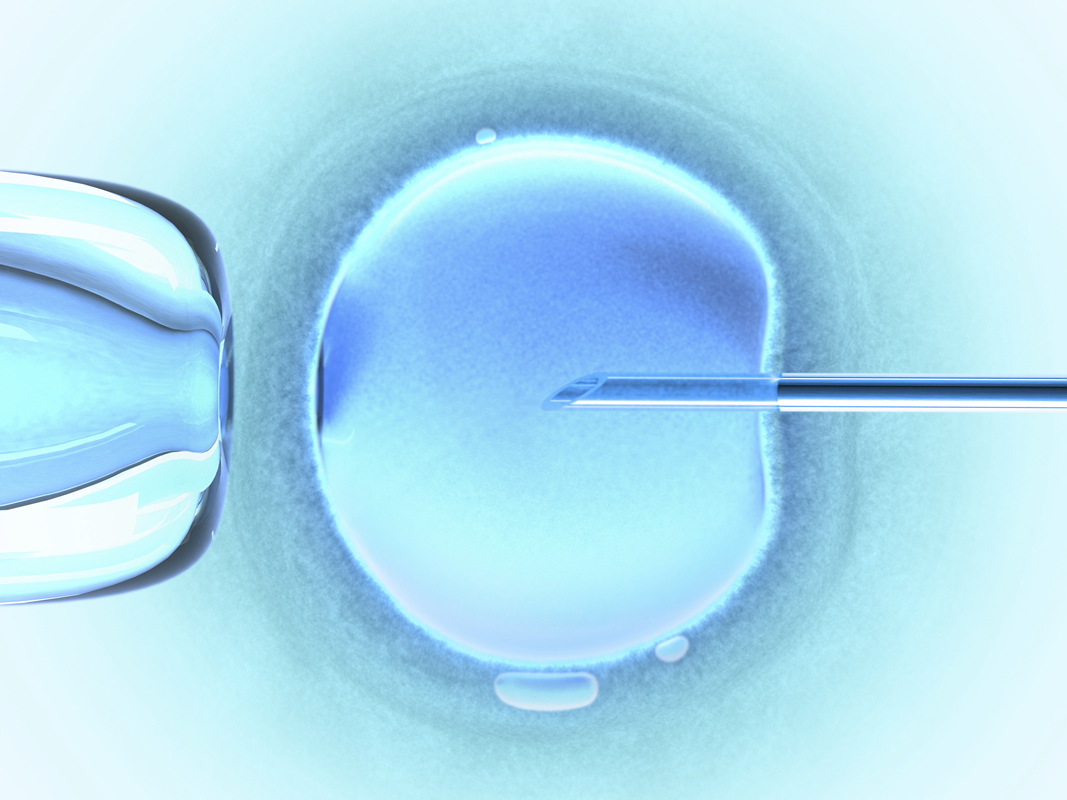 Εξωσωματική γονιμοποίηση (IVF)